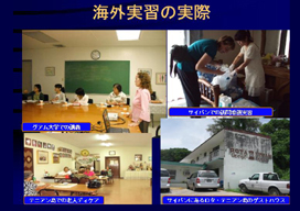 �C�O���K�̎���