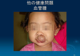 ���̌��N���<br>���ǎ�